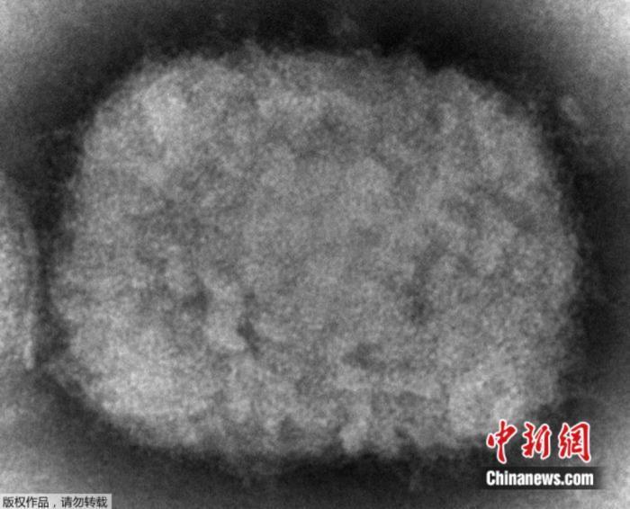 资料图:美国疾病控制和预防中心(CDC)提供的2003年电子显微镜图像显示了一种猴痘病毒粒子。 资料图:美国疾病控制和预防中心(CDC)提供的2003年电子显微镜图像显示了一种猴痘病毒粒子。